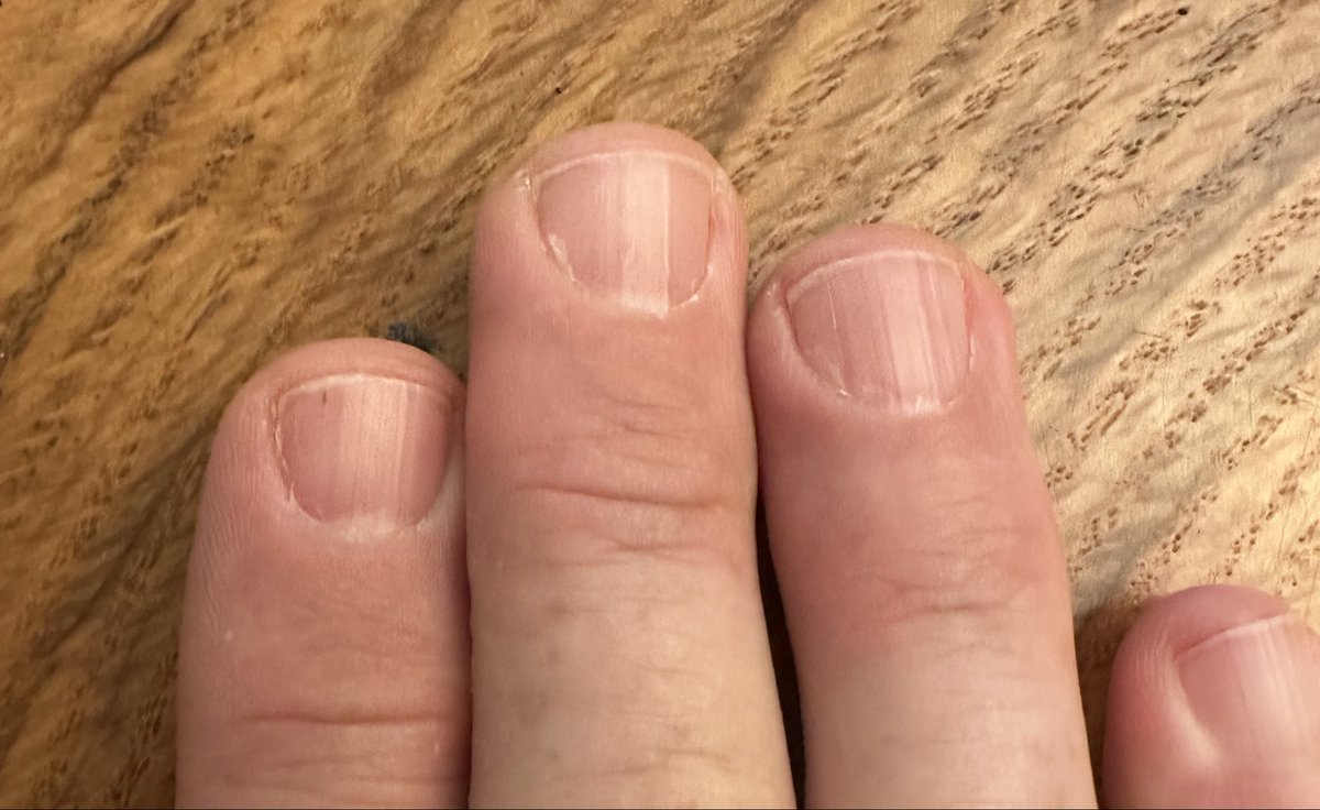 Mark Shires, ATC tweet media