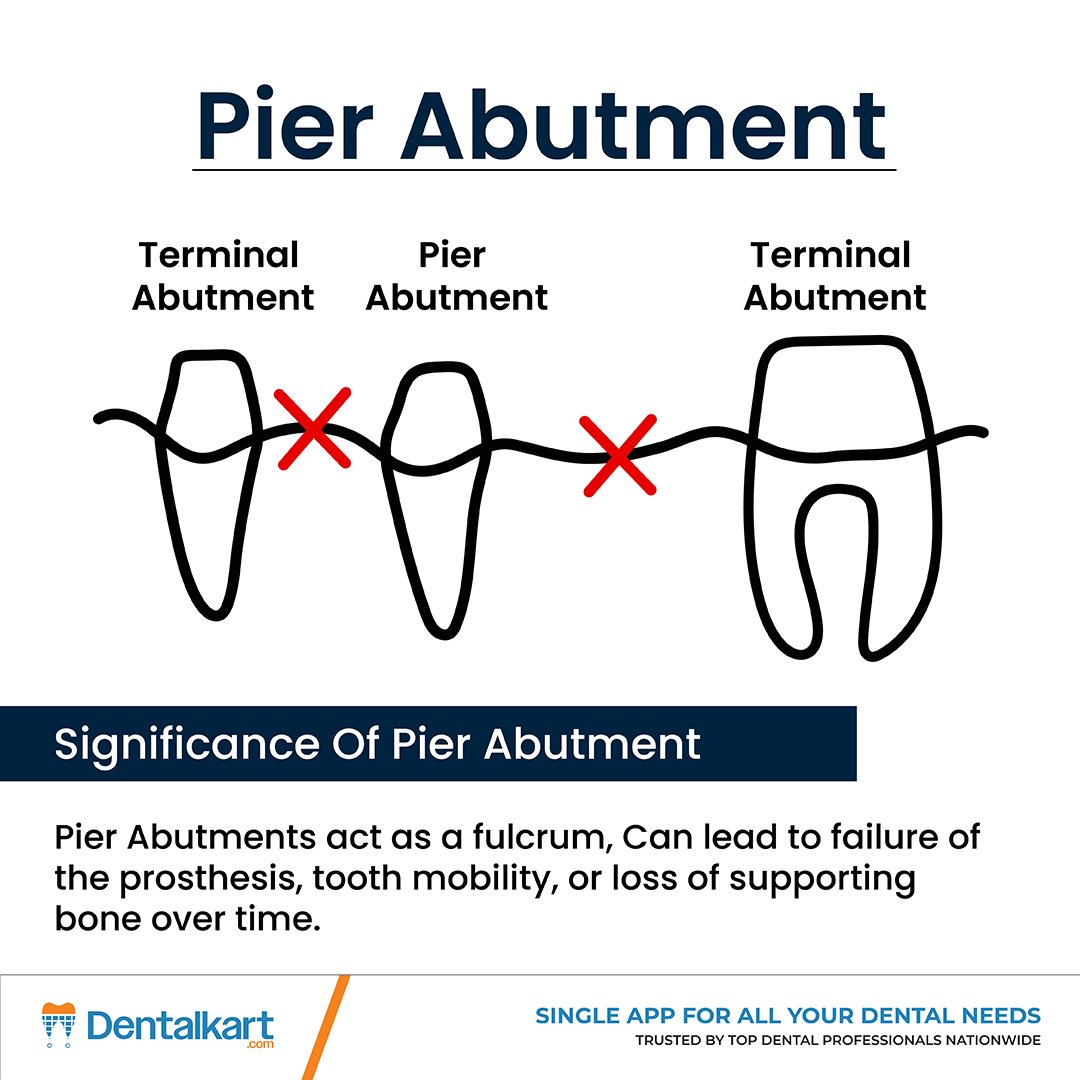 Dentalkart's tweet image. Know Your Pier Abutment!

-Acts as a fulcrum, risking prosthesis failure.
-May cause tooth mobility over time.
-Can lead to bone loss around the abutment.

Design smart, plan strong — protect your prosthesis!  

#DentalFacts #Prosthodontics #PierAbutment #DentalEducation