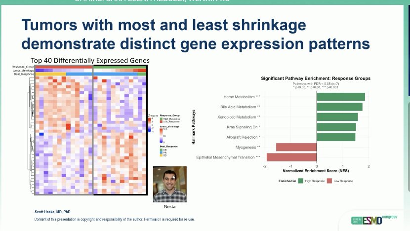 In #OPTICRCC, metastatic #ccRCC patients with cluster 1/2 (#angiogenic) tumors tx w/ cabo/nivo showed 71% ORR (&amp;100% tumor reduction rate), an increase relative to unselected historical controls. Important trial evaluating #biology &amp; #VEGF dependence of ccRCC #ESMO25
