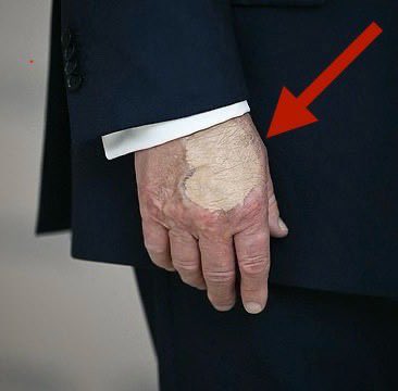 “I will tell you about his signs so that you will know him: he is a skinny-legged young man, having a tuft of gray hair at the front of his bald head. His eyebrows will reach to his ears. There is a leprous bare spot on the front of his hands. He will change before those who look