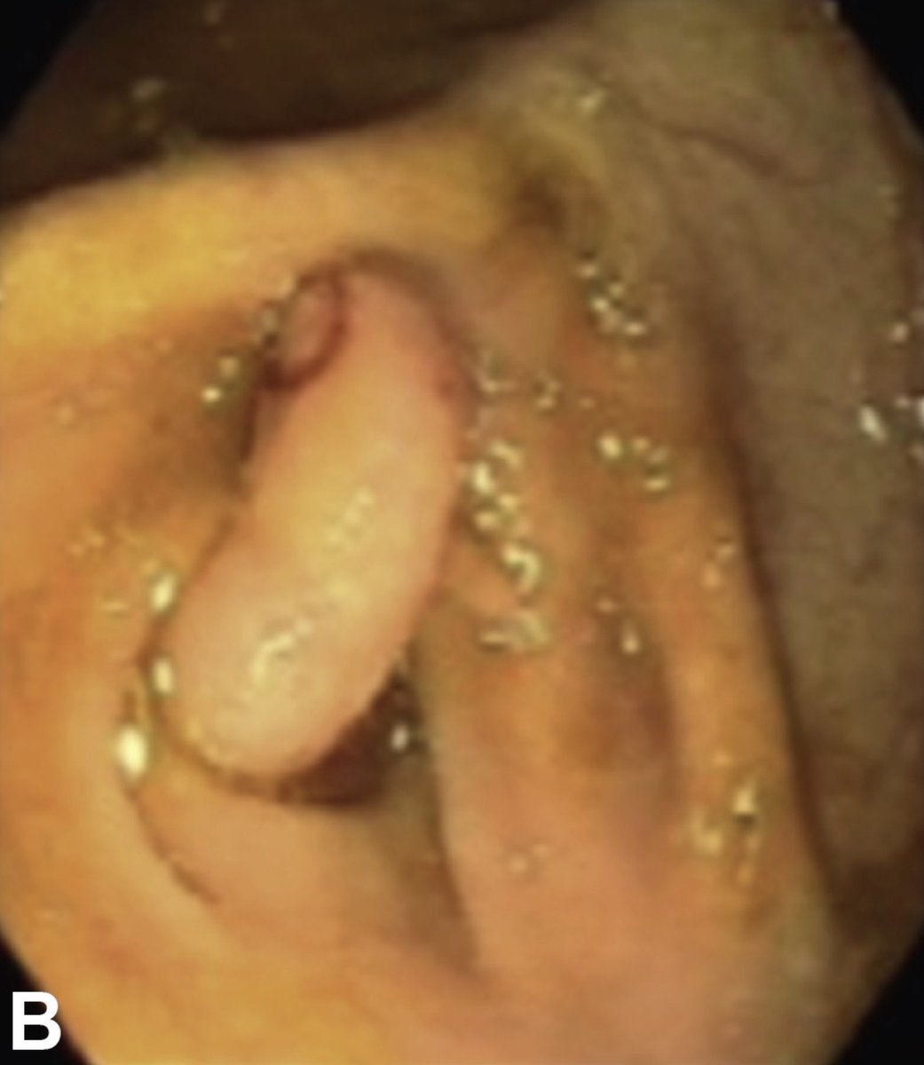 Keith Siau tweet media