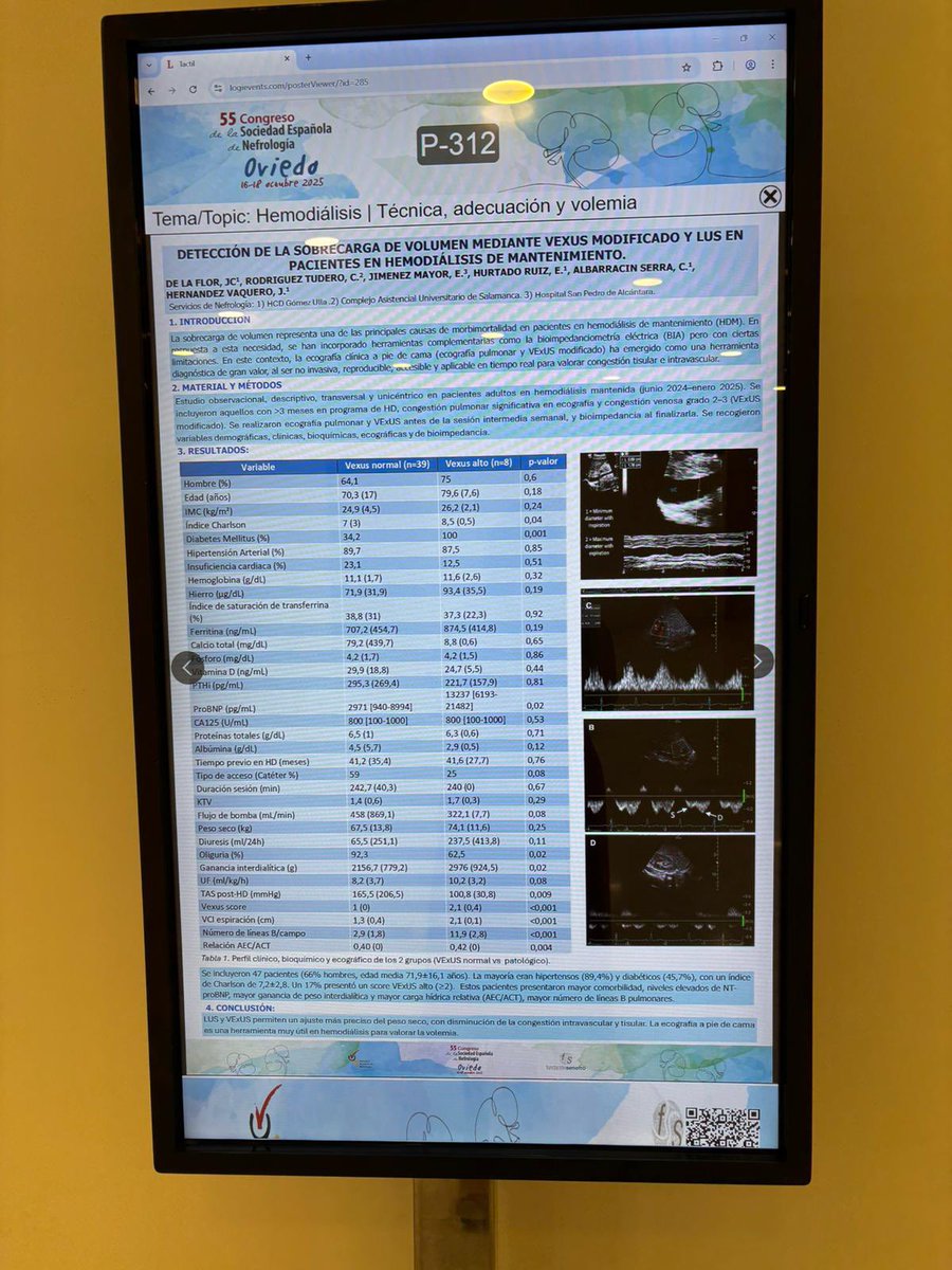 Nuestro grupo estuve presente en la #senefro25 con póster,
Eposter y simposium participando en estudios uni como multicentricos gracias <a href="/SENefrologia/">S.E.N. Nefrología</a> y equipo #jesusHernandez <a href="/celiartudero/">Celi pocket 🥰</a> <a href="/ElenaJMDoc/">Elena Jimenez</a> <a href="/AvinashChandu22/">Avinash Chandu</a> <a href="/SOMANEorg/">Sociedad Madrileña de Nefrología (SOMANE)</a> <a href="/senjoven/">JovSEN</a> <a href="/MEDICINA_UPCH/">Medicina - Cayetano</a> <a href="/UAHes/">Universidad Alcalá</a>
