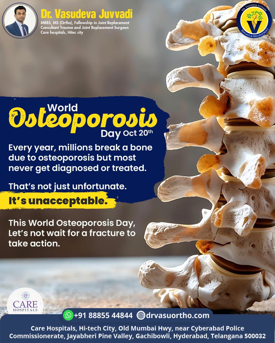 drvasudevaortho's tweet image. Weak bones can strike silently! Protect yourself from fractures with early screening &amp;amp; expert care. Stay active, stay strong! 💪

👨‍⚕️ Dr. Vasudeva Juvvadi
📞 +91 88855 44844
🌐 drvasuortho.com

#DrVasudevaJuvvadi #tOrthopedicSurgeon #RoboticSurgeon #OsteoporosisAwareness