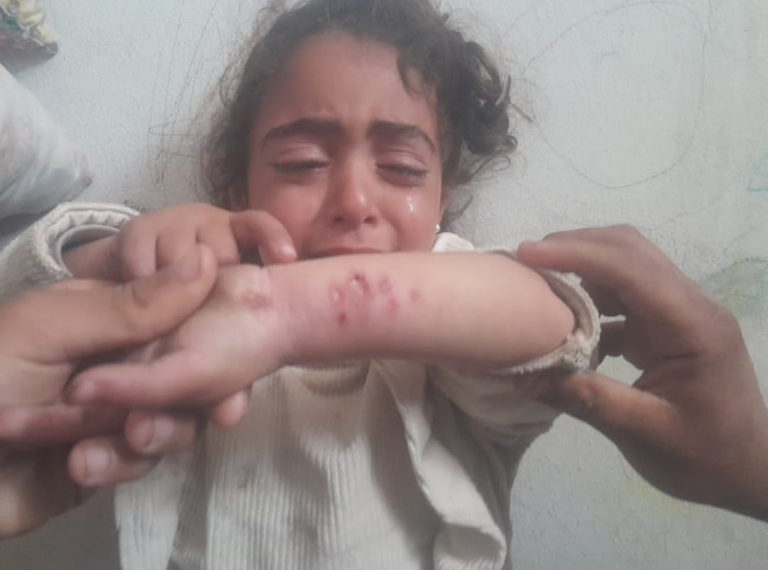 One point can save my life. Is it too big for me? 😥🙏🍉🍉
Ten people, each person $50, we make a difference 
If you are browsing please leave a point my health is deteriorating 🙏🇵🇸👇
chuffed.org/project/148184…