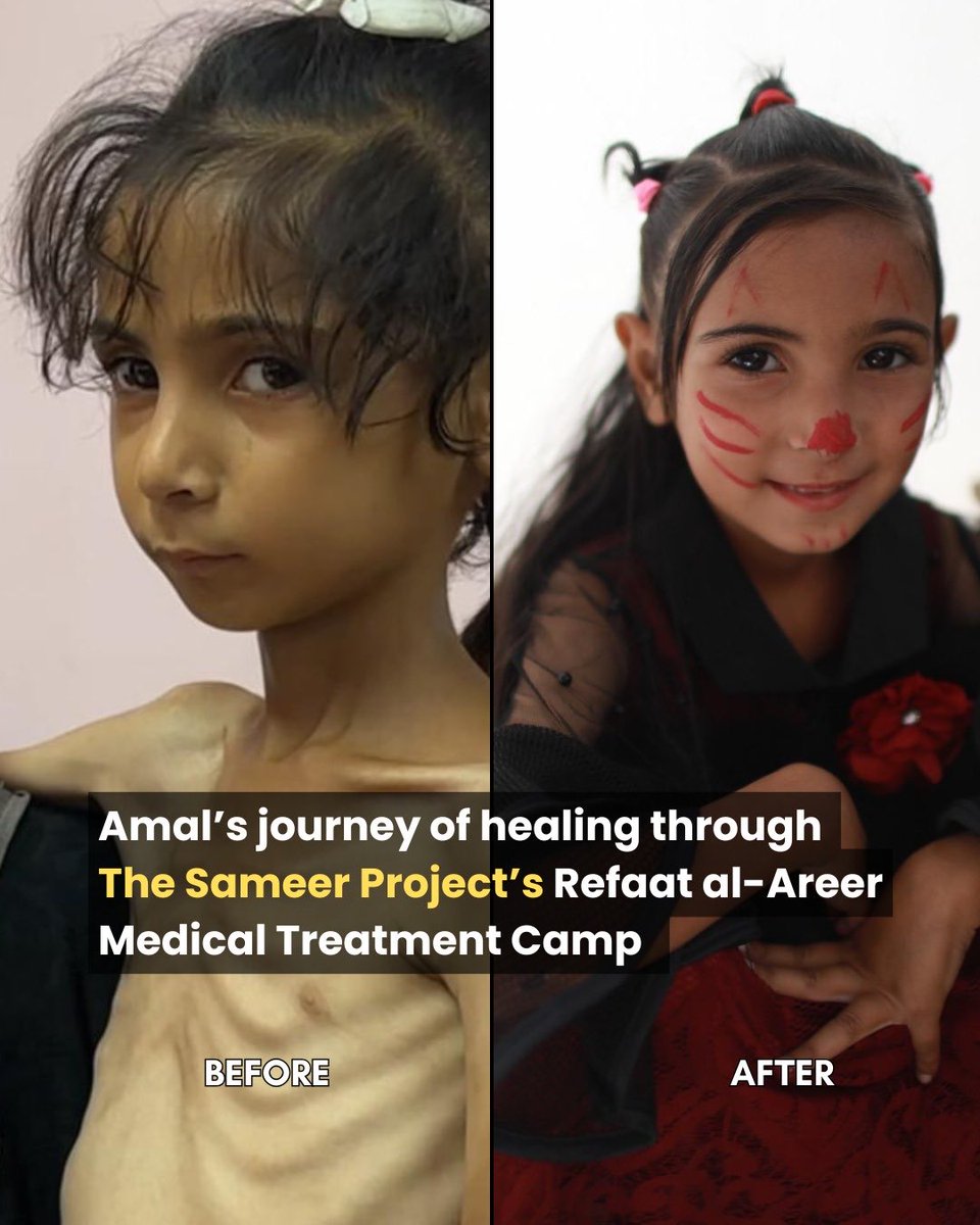 sameerproject's tweet photo. Four months ago, Amal Al Bayouk was hospitalized due to malnourishment. Once discharged, the family moved into the Refaat Alareer Camp where Amal was given special care and high caloried supplements and food packages. Support: https://t.co/dT6xhwzZFU

Today Amal’s face is bright with her big cheeks, and this picture on the right is of her attending her school opening last week. Amal is happy as she went to her first day of school today. She is back to being a happy healthy child.

Support the Refaat Alareer Camp by the Sameer Project to support Amal and other kids in their health journey: https://t.co/dT6xhwzZFU

Other ways to donate include:
https://t.co/OmIU4SifDD (Paypal option, please make sure to add a message saying "Camp")
https://t.co/WNZu0ERJci (Venmo option, please make sure to add a message saying "Camp”)