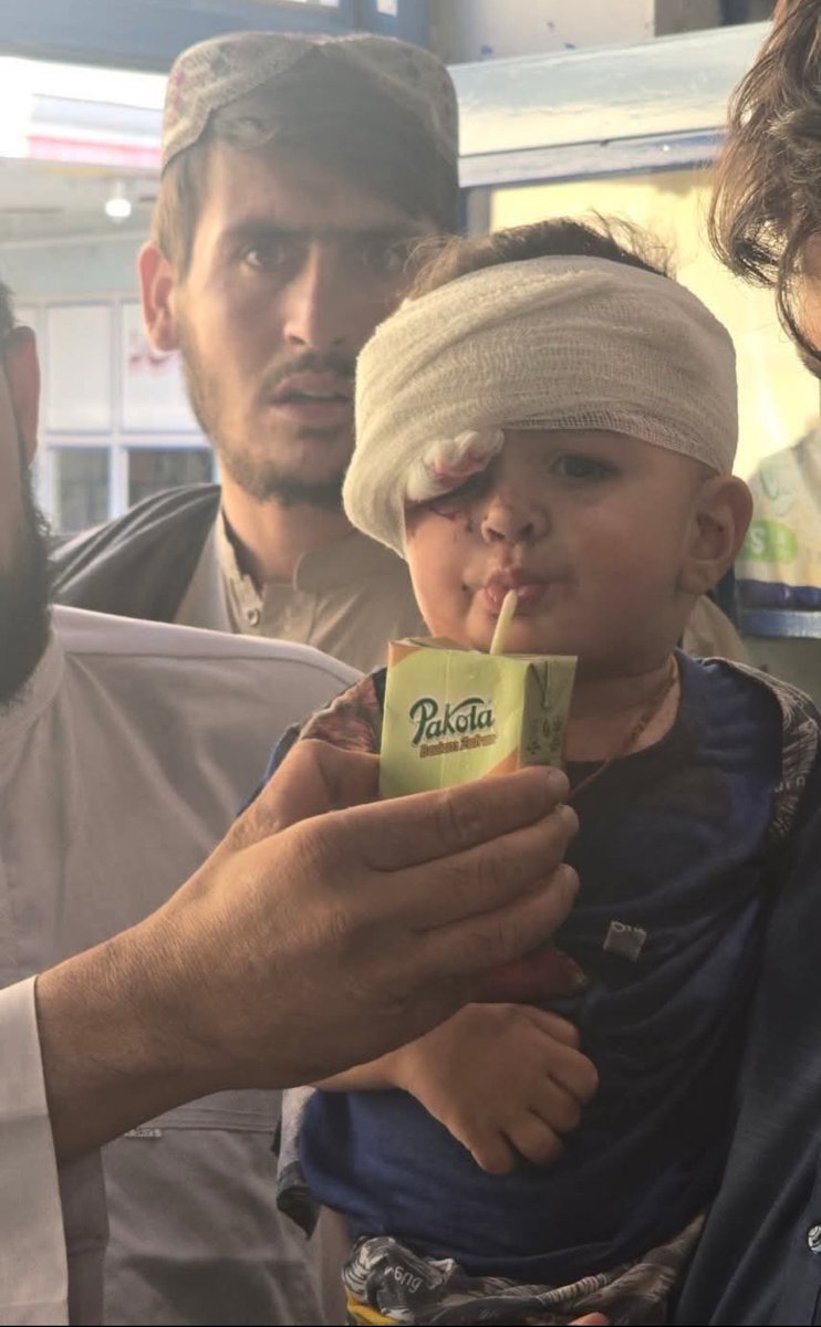 Magadhii_'s tweet image. Punjabi Pakistani army is a terrorist army... Pakistan should be ashamed that it is targeting even an innocent child like a flower. 🤬🤬🤬

#PakistanIsATerrorState #AfghanistanAndPakistan