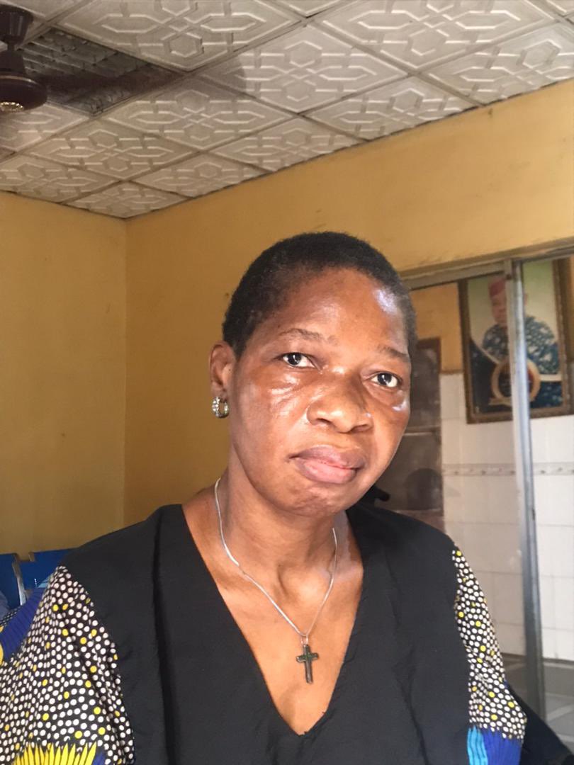 allaboutwura's tweet image. Hi,I'm here again. My mum was diagnosed with ALS which isn't curable but can be maintained,it requires daily medication which costs a lot.Please if you see this and can donate or even just a retweet,i would appreciate
2343616614 Uba WuraolaOyenola
8140596483 Opay AdesewaOyenola