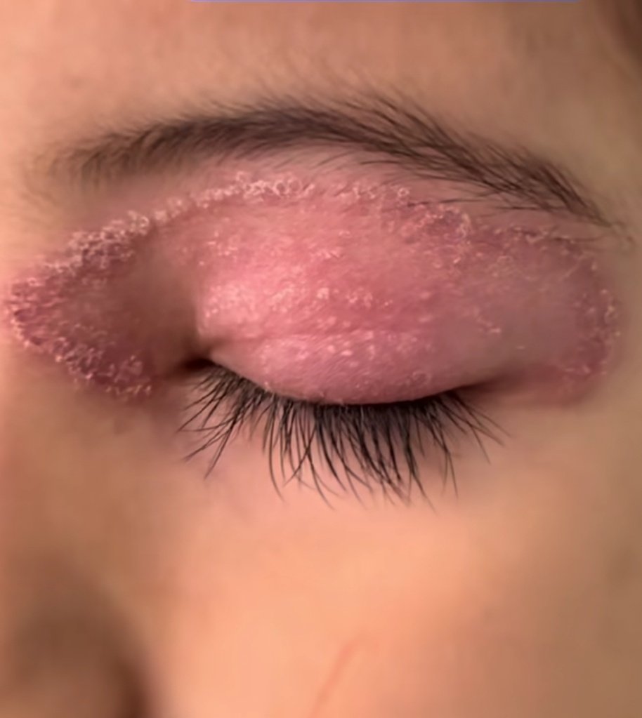 What is the diagnosis?