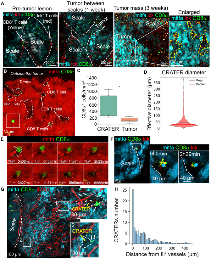 LabWaggoner's tweet image. CD8 T engage tumor cells in antigen presentation molecule-rich pockets termed CRATERs that expand & breach tumor mass from the stromal compartment, as major site of tumor killing during treatment @CellCellPress @aya_ludin
cell.com/cell/fulltext/… @leonard_zon
@BostonChildrens