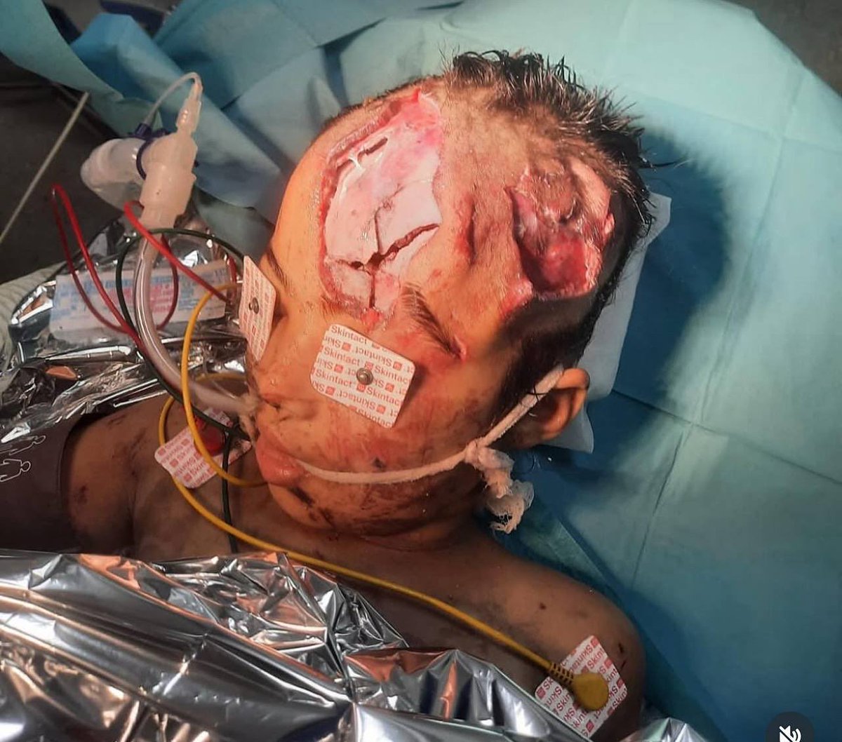 MosabAbuToha's tweet image. A little bit?