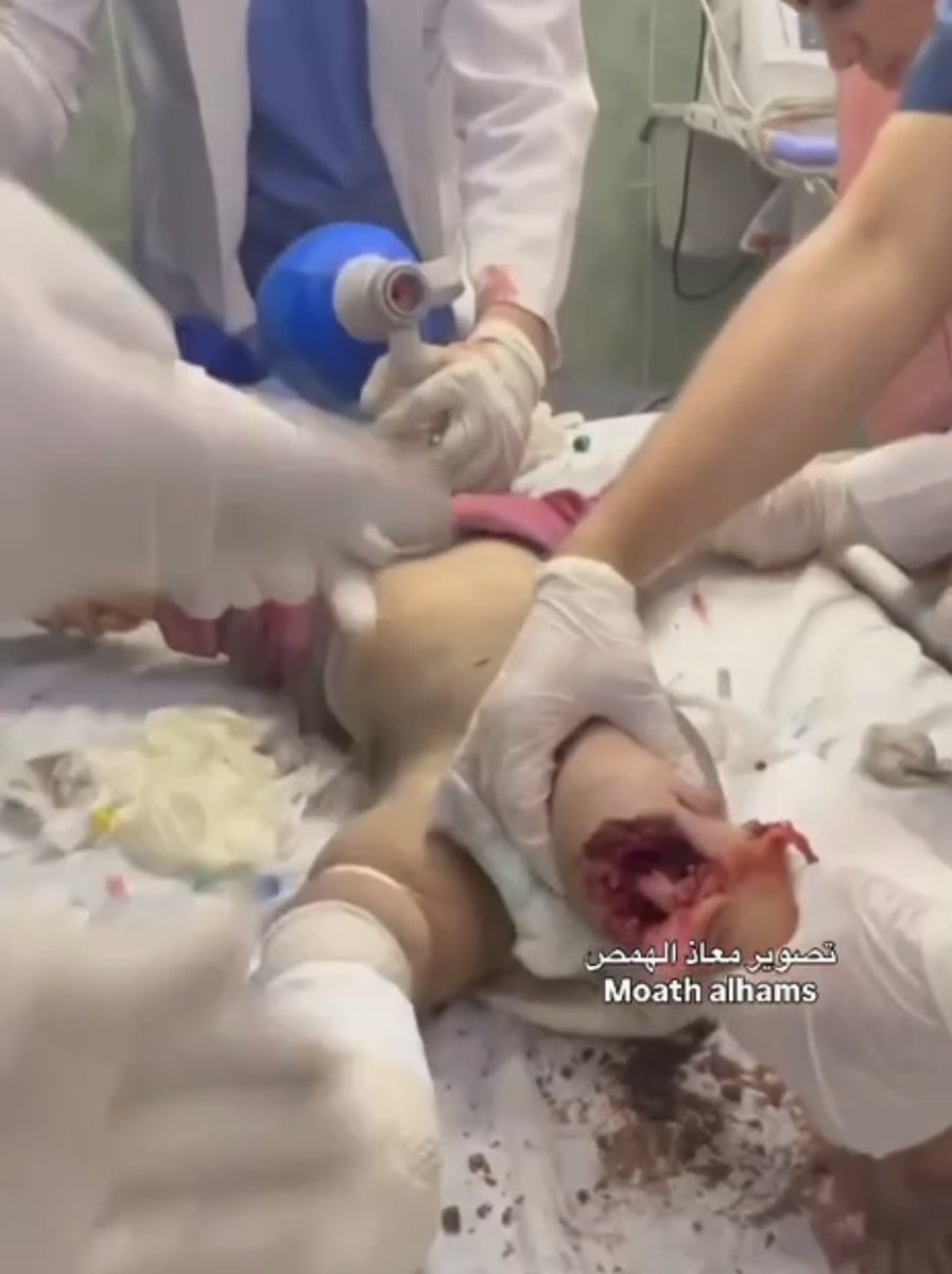 MosabAbuToha's tweet image. A little bit?