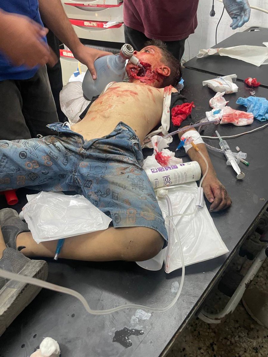 MosabAbuToha's tweet image. A little bit?