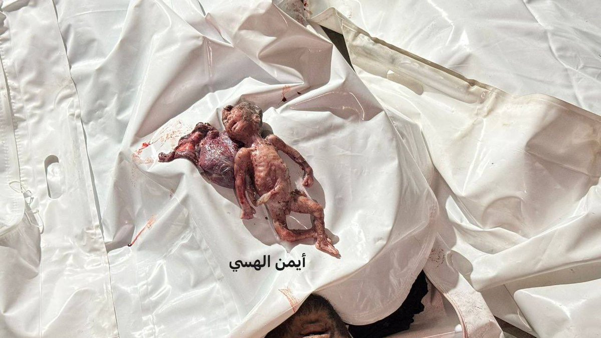 MosabAbuToha's tweet image. A little bit?