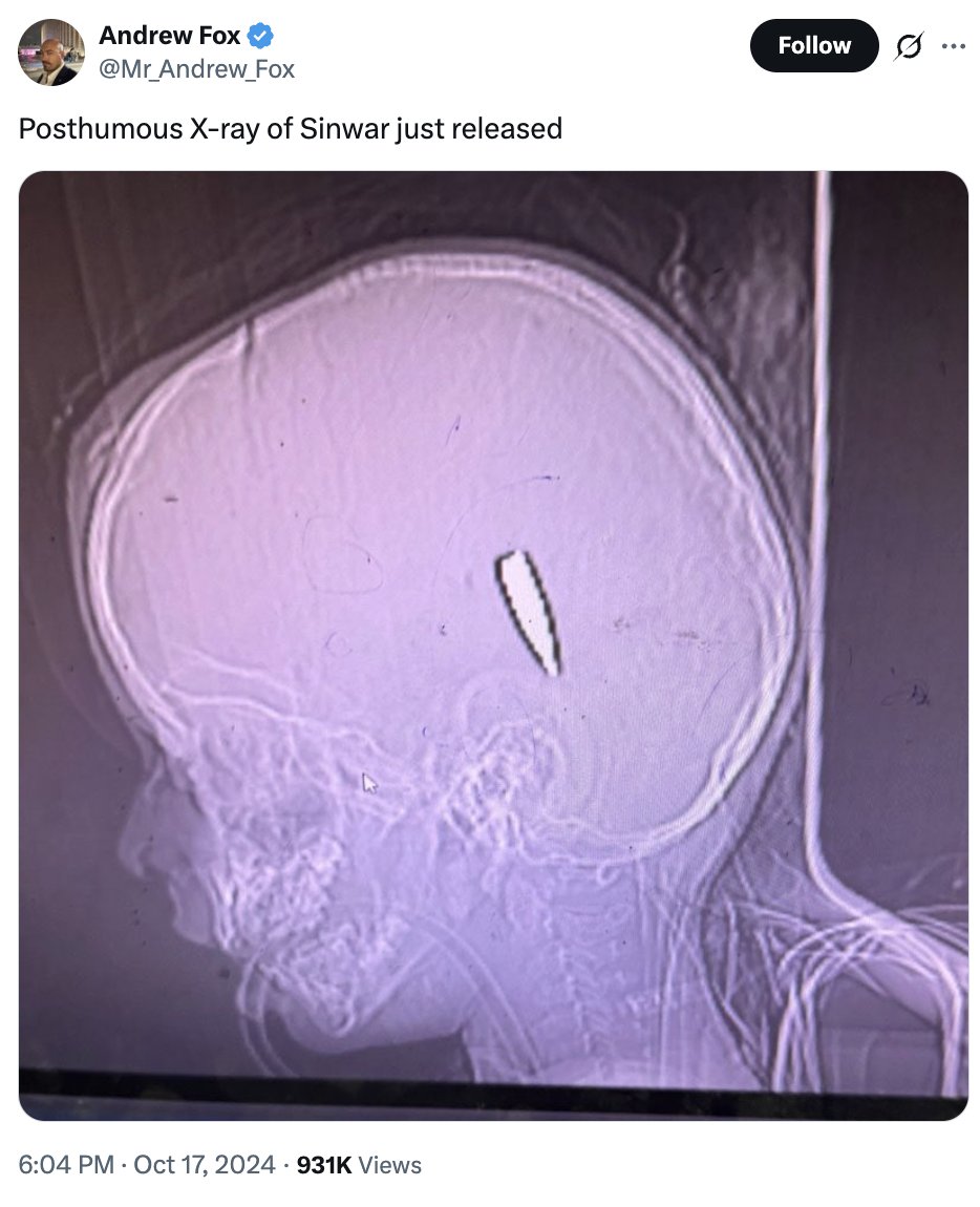 owenjonesjourno's tweet image. This sick man posted a X-ray of a Palestinian child with an Israeli bullet in their skull - and joked about it.
He claimed a New York Times feature about Israeli snipers killing Palestinian kids - based on dozens of testimonies from US medics and 160 photos + videos - was a hoax