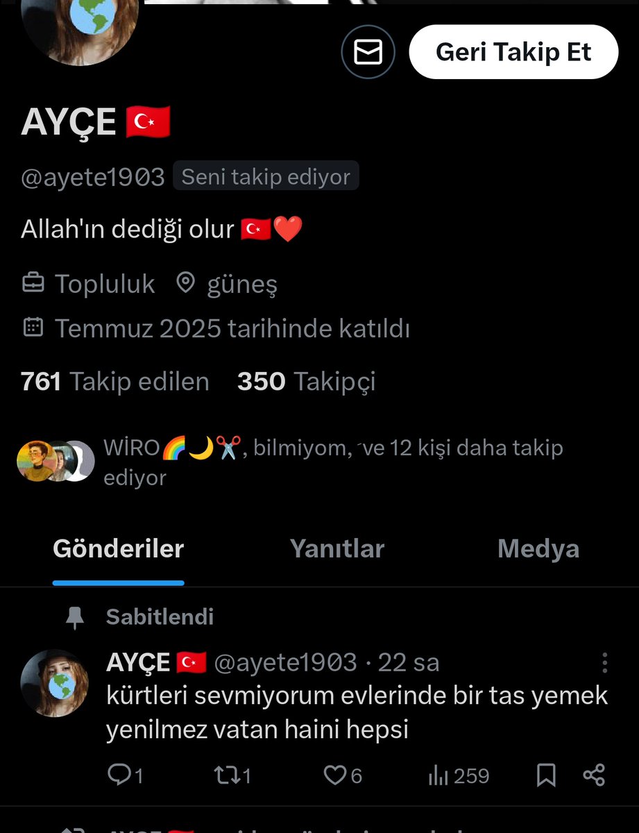Bi de bu sabit tweetiyle beni takip etmiş kalk siktir git aq