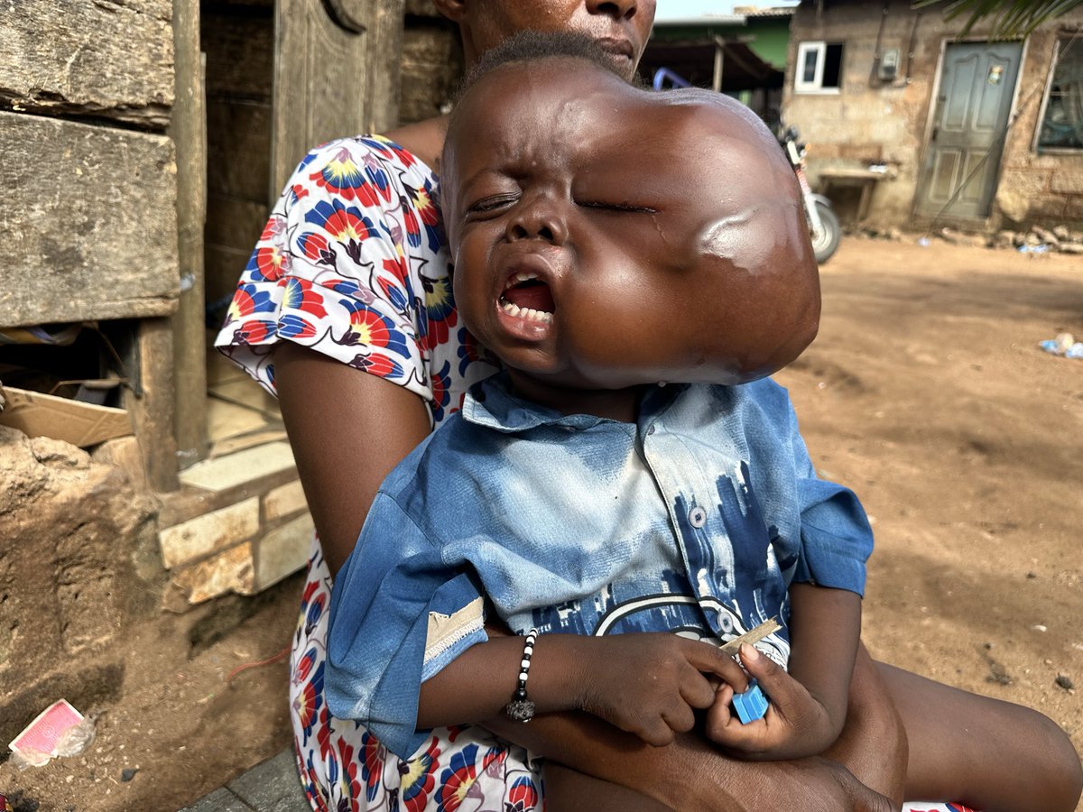 Bones Man (@bonesmantv) on Twitter photo UPDATEโผ๏ธ
We are now left with GHc20,000 more to complete it. GHc50,000 raised so far.
I need 200 people to support with 50 or 100cedis to help complete this Donation please.๐
Even if you donโt have, please repost.๐
๐๐ถ๐ฎ๐น *713*034# OR
๐๐จ๐ง๐๐ญ๐ ๐ฏ๐ข๐ ๐๐จ๐๐ข๐ฅ๐ UPDATEโผ๏ธ
We are now left with GHc20,000 more to complete it. GHc50,000 raised so far.
I need 200 people to support with 50 or 100cedis to help complete this Donation please.๐
Even if you donโt have, please repost.๐
๐๐ถ๐ฎ๐น *713*034# OR
๐๐จ๐ง๐๐ญ๐ ๐ฏ๐ข๐ ๐๐จ๐๐ข๐ฅ๐