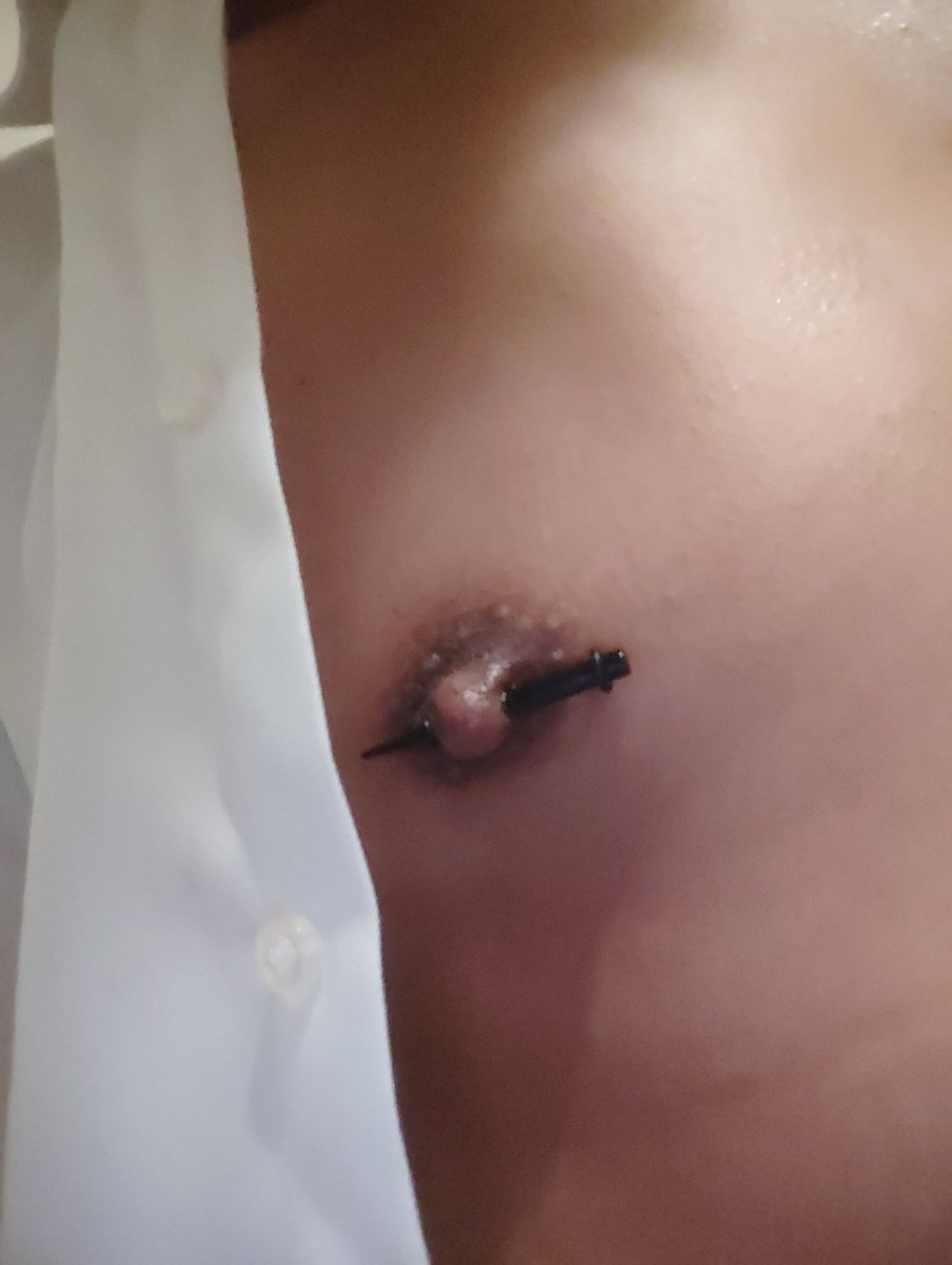 🏳️‍⚧️Linlin琳琳酱🍥 tweet media