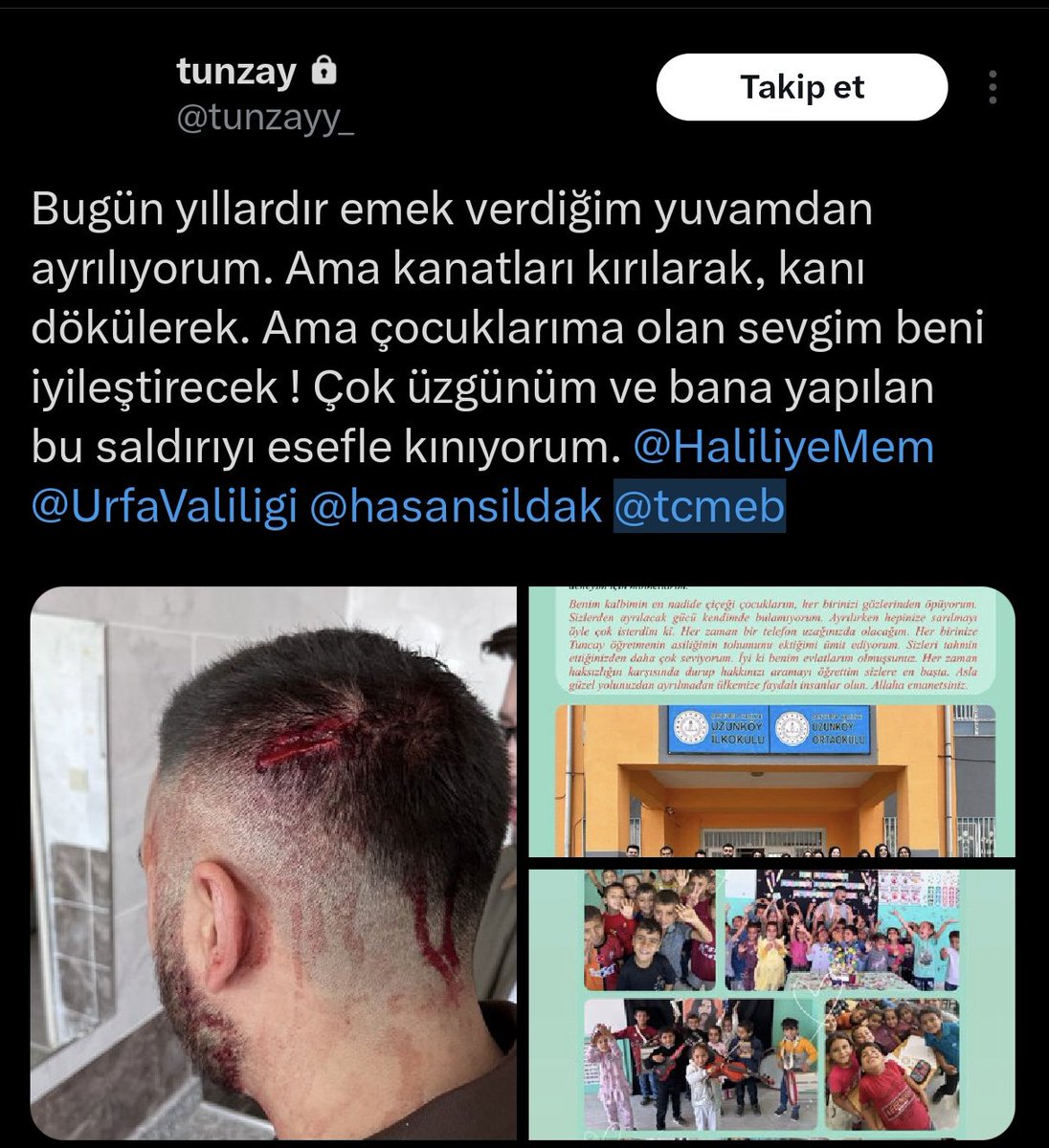 makifozcan's tweet image. Bir yanda uğradığı şiddete rağmen &quot;çocuklara olan sevgim beni iyileştirecek!&quot; diyen bir öğretmen var

Diğer yanda HİÇ BİR ŞEY YAPMAYAN milli eğitim yöneticileri ve MÜLKİ İDARECİLER var. 

Ayıptır!
Öğretmenlik mesleğini ayaklar altına düşürdünüz. 
YETER ARTIK! 
#öğretmen #şiddet