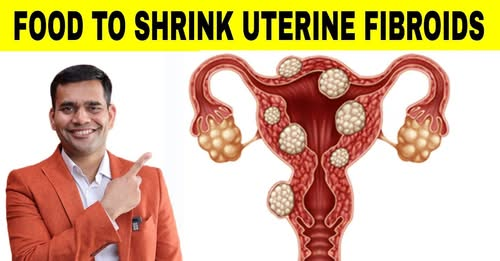 johnchukwu552's tweet image. 7 Foods for Shrinking Fibroids : Click and learn more infertilityfactsjcb.blogspot.com/2025/10/7-food… 

#HormoneBalance
#EstrogenDominance
#Inflammation
#WomensHealth
#HealthyEating
#NutritionTips