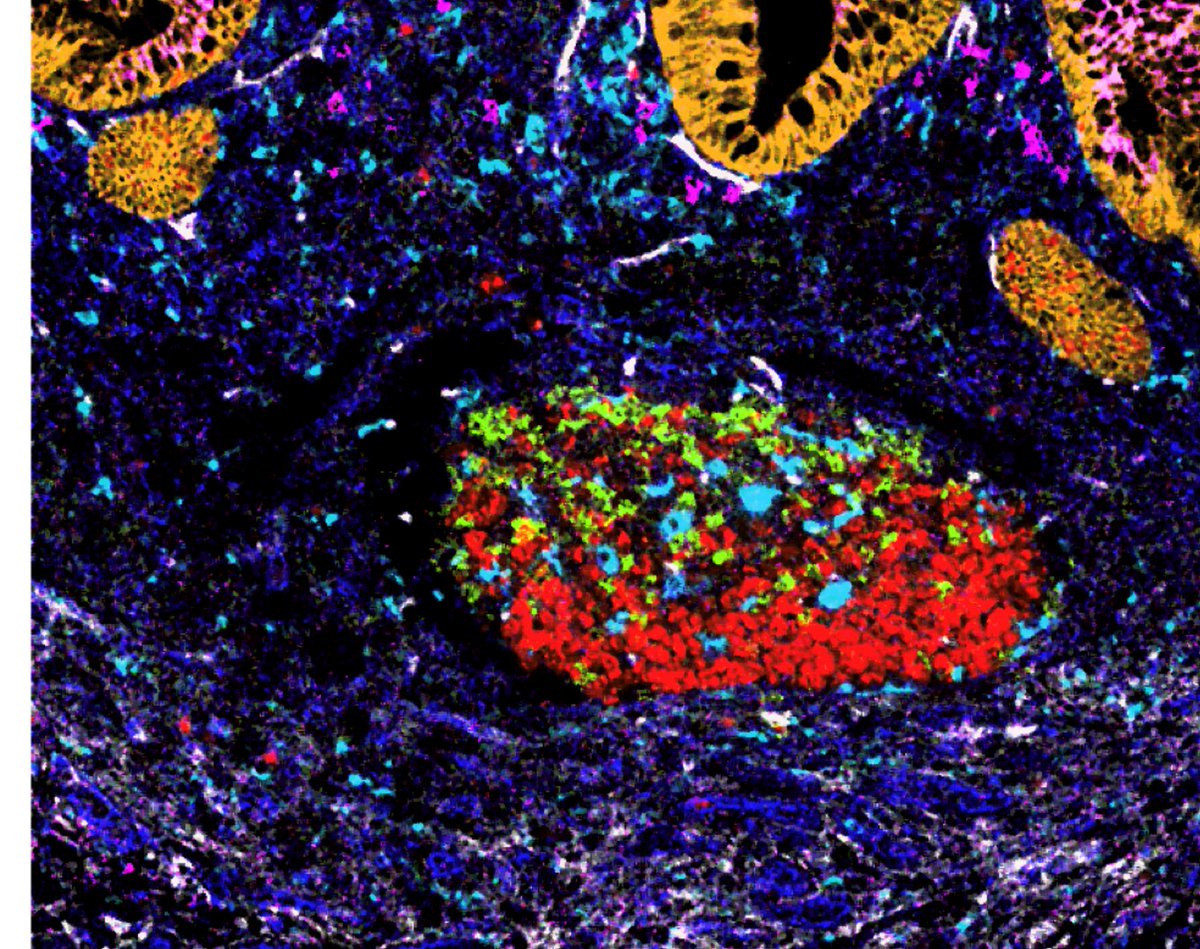 Jacqueline HY Siu tweet media