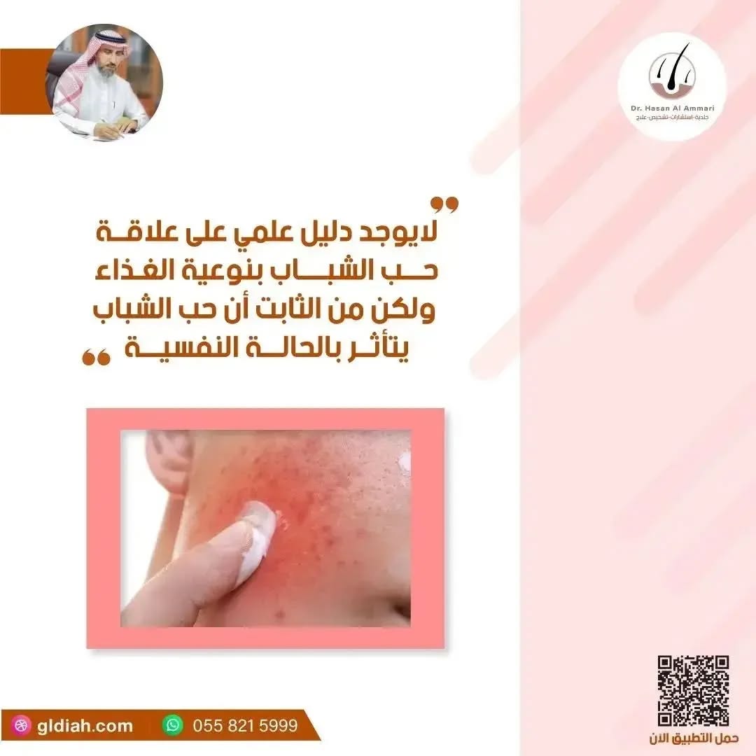 🔶لا يوجد دليل علمي
 على علاقة حب الشباب بنوعية الغذاء 
ولكن من الثابت أن حب الشباب يتأثر بالحالة النفسية.

.

.

#حب_الشباب 
#حب_الشباب_وأثاره 
#جلدية #السعودية