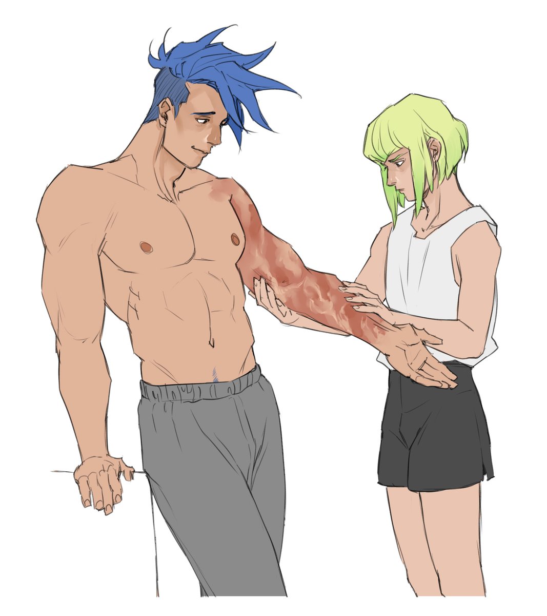 Whumptober Day 16 - Burn
#PROMARE