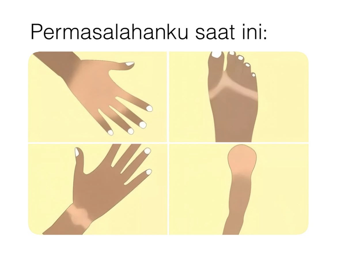 martabakismissu's tweet image. The problem                        The solution