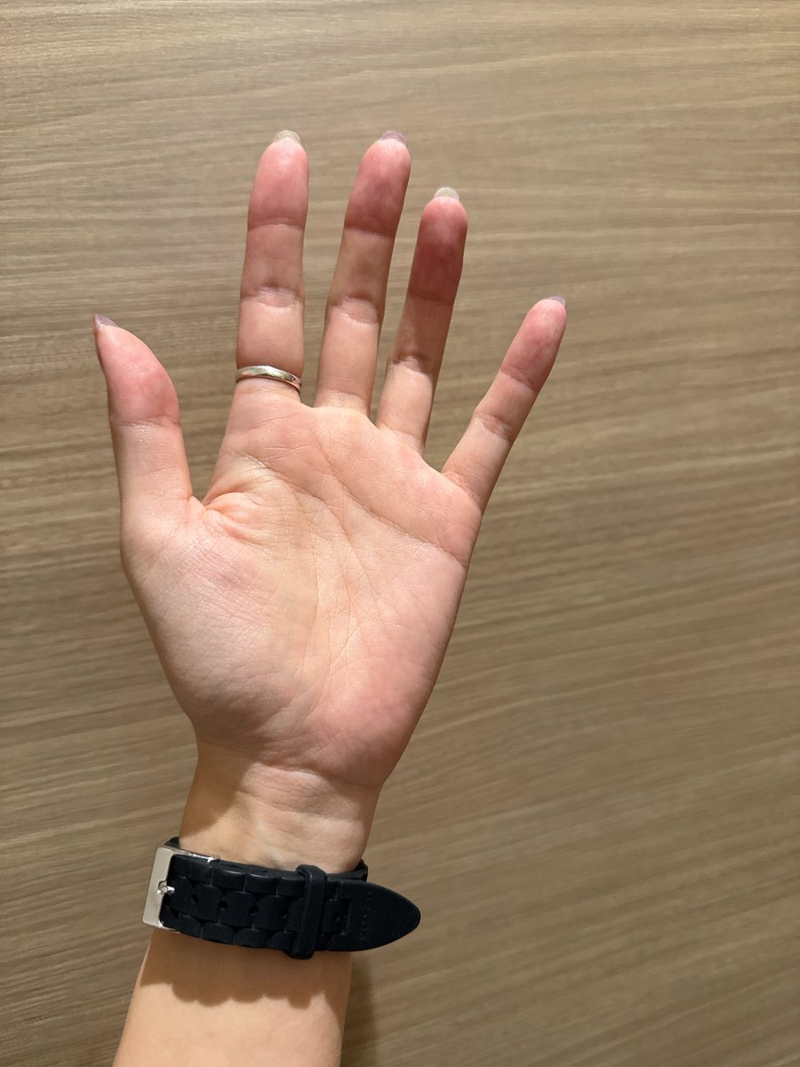 仙蔵とハイタッチできました
そこからの記憶はありません