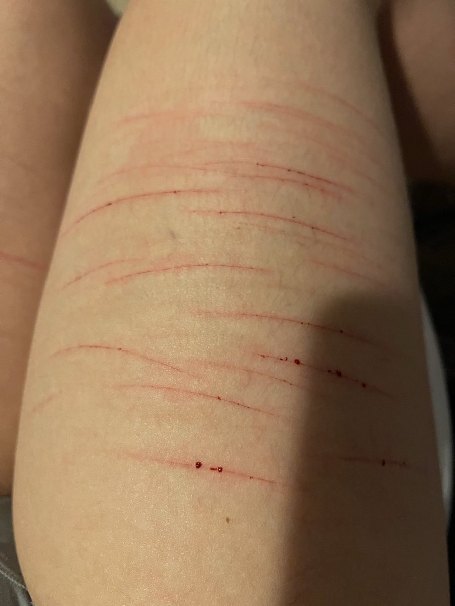 12 days of torture