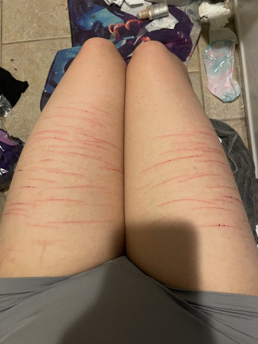 you can tell which leg is my mortal enemy