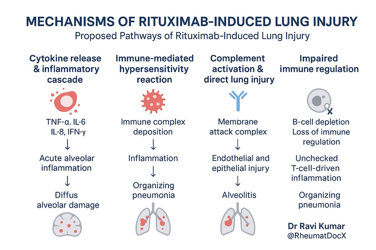 🧵 Rituximab-Induced Lung Injury (RILI): A rare but serious complication 🫁

1️⃣ Overview
Rituximab is generally safe, but &lt;1% of patients develop lung injury.
Onset: within days–weeks of infusion (sometimes delayed).
Can occur after any cycle, though early cycles are more
