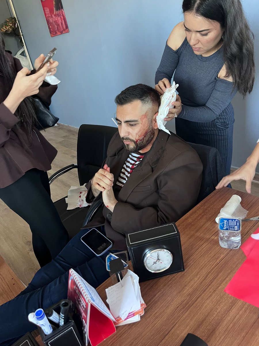 OrhanYILDIRIM__'s tweet photo. Bu kez Görevi başında öğretmene şiddetin yeri Şanlıurfa .
-GÖREVİ BAŞINDAKİ KAMU ÇALIŞANINA ŞİDDET UYGULAYANLAR DERHAL TUTUKLANMALIDIR.
Şanlıurfa'nın Haliliye ilçesine bağlı Uzunköy'de görev yapan Tuncay öğretmen, görevi başındayken sopayla saldırılarak yaralanmıştır 

Öğretmenlerimiz yalnız değildir! 
Saldırganlar hakettiği cezayı akıncaya kadar takipçisi olacağız.