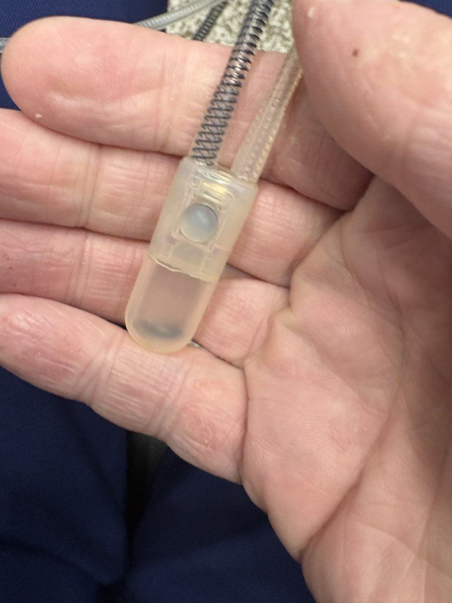 Matt Forde (@mattforde) on Twitter photo I won’t be on <a href="/absoluteradio/">Absolute Radio</a> for a few weeks as I’m having an operation on Thursday that will blow your mind. 
As a result of the life-saving spinal surgery I had two years ago, the nerves to my bladder and bowel were cut. This has left me with a stoma for solids and the need to I won’t be on <a href="/absoluteradio/">Absolute Radio</a> for a few weeks as I’m having an operation on Thursday that will blow your mind. 
As a result of the life-saving spinal surgery I had two years ago, the nerves to my bladder and bowel were cut. This has left me with a stoma for solids and the need to