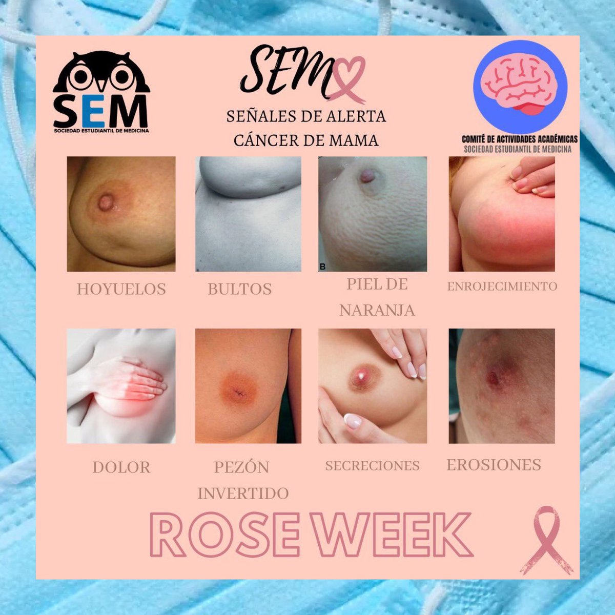 El cáncer de mama es el más frecuente entre las mujeres en España. Pero es también uno de los que más supervivencia tiene.⁣
⁣
Apostemos por la investigación y el diagnóstico temprano, en un cáncer que los hombres también pueden sufrir.

#DiaMundialdelCancerdeMama