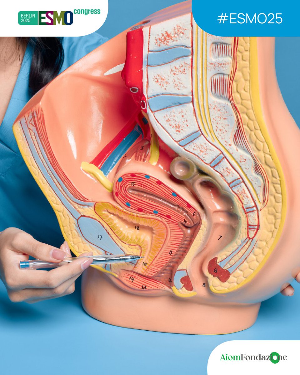 Il paradigma di cura del #tumoredellavescica muscolo-invasivo potrebbe cambiare: a dirlo sono i risultati dello studio di Fase III #KEYNOTE-905, presentati ad #ESMO25. 

L’articolo: medinews.it/comunicati/tum…