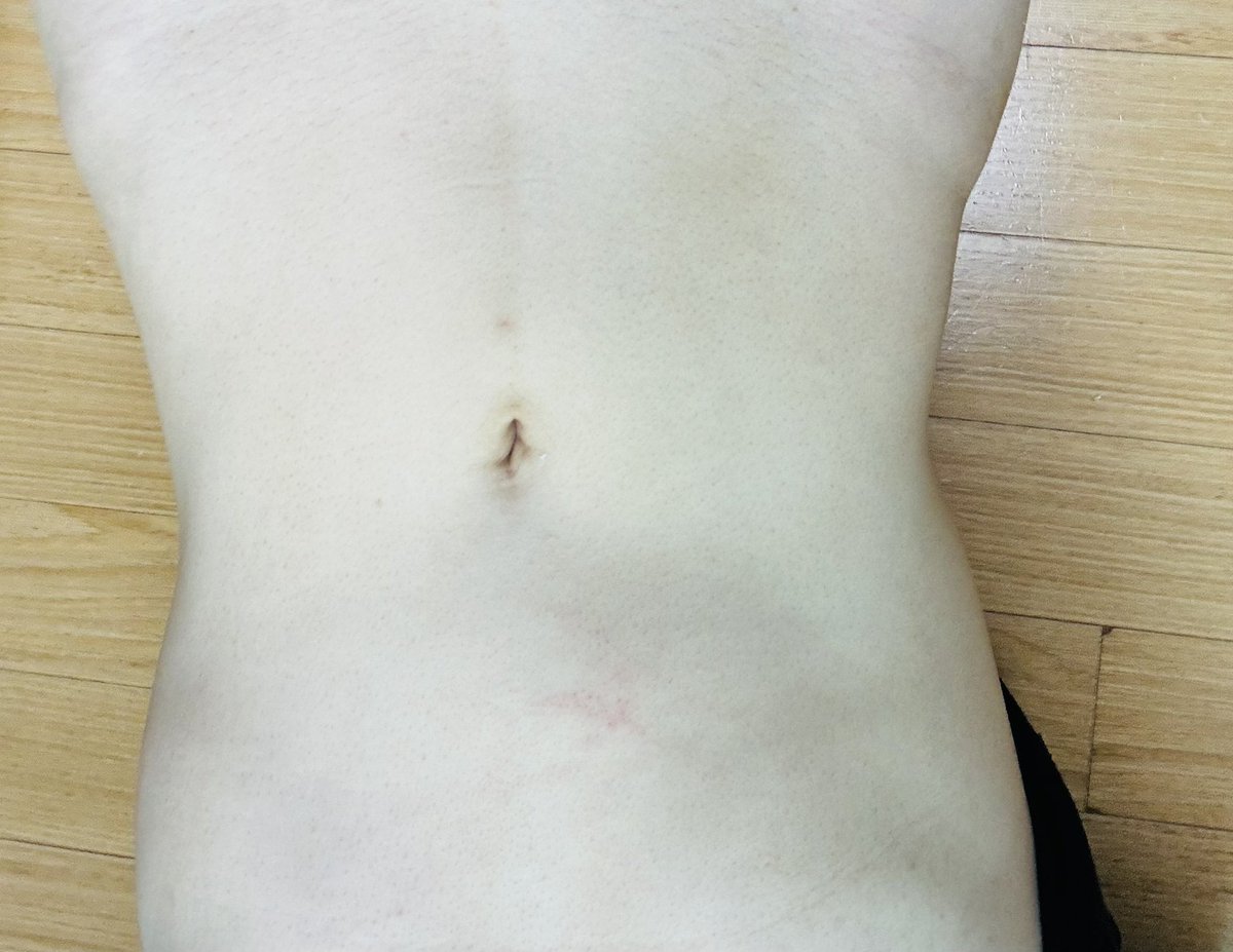 patch0122's tweet image. 현재 59키로
보추는 아닌데 배가 예쁨
