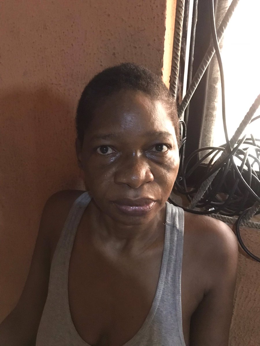 allaboutwura's tweet image. Good morning, I’m seeking financial help for my mother, who has ALS, an incurable disease that requires significant funds for care. If you see this post, please retweet and any donations would be greatly appreciated

2343616614 Uba Wuraola Oyenola

8140596483 Opay Adesewa Oyenola