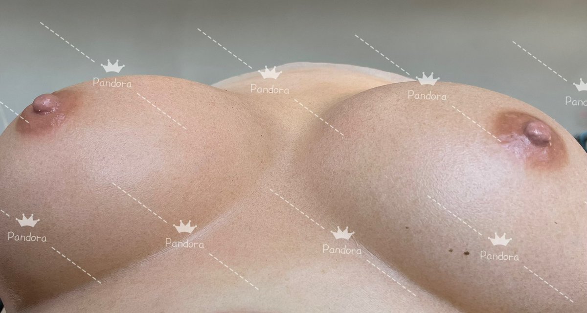 我想枕着这两坨肉肉入睡😆😆😆
你想不想……
#潘多拉魔盒 #伪娘 #变装 #面具 #MTF #maletofemale #特效化妆 #specialeffectmakeup #直播 #义乳 #cosplay #医疗假体