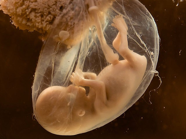 RodolfoAdrin5's tweet photo. @totiorellanag @ClaudiaDonaireG @ximenaguilera El mayor cáncer y daño que se realiza a la mujer,  es impulsarla a no aceptar a su bebe en el vientre con leyes de Aborto. Estas,  solo perjudican a la madre embarazada y  la llevan a elegir desechar a su hijo(a). https://t.co/0IcK59vaW9
