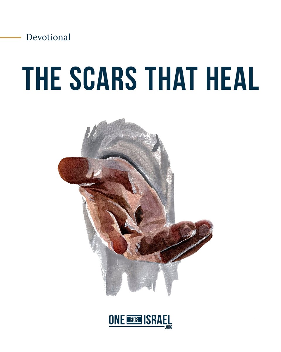 “Then He said to Thomas, ‘Reach here with your finger, and see My hands; and reach here your hand and put it into My side; and do not be unbelieving, but believing.’ Thomas answered and said to Him, ‘My Lord and my God!’” (John 20:27–28).

Some people are saying the war between