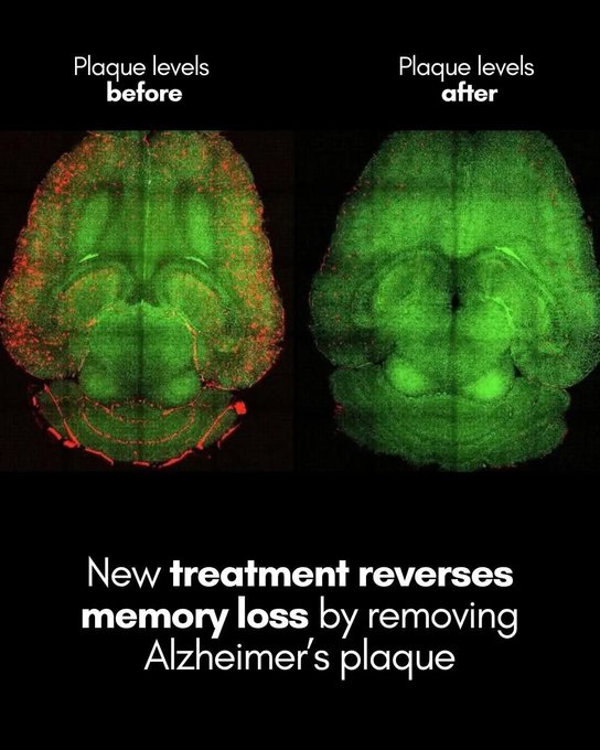 Researchers from Spain and China achieved a significant advance in Alzheimer’s research by developing nanoparticles that clear toxic brain plaque, a key contributor to the disease, and reverse memory loss in mice. 

Published in Signal Transduction and Targeted Therapy, the study