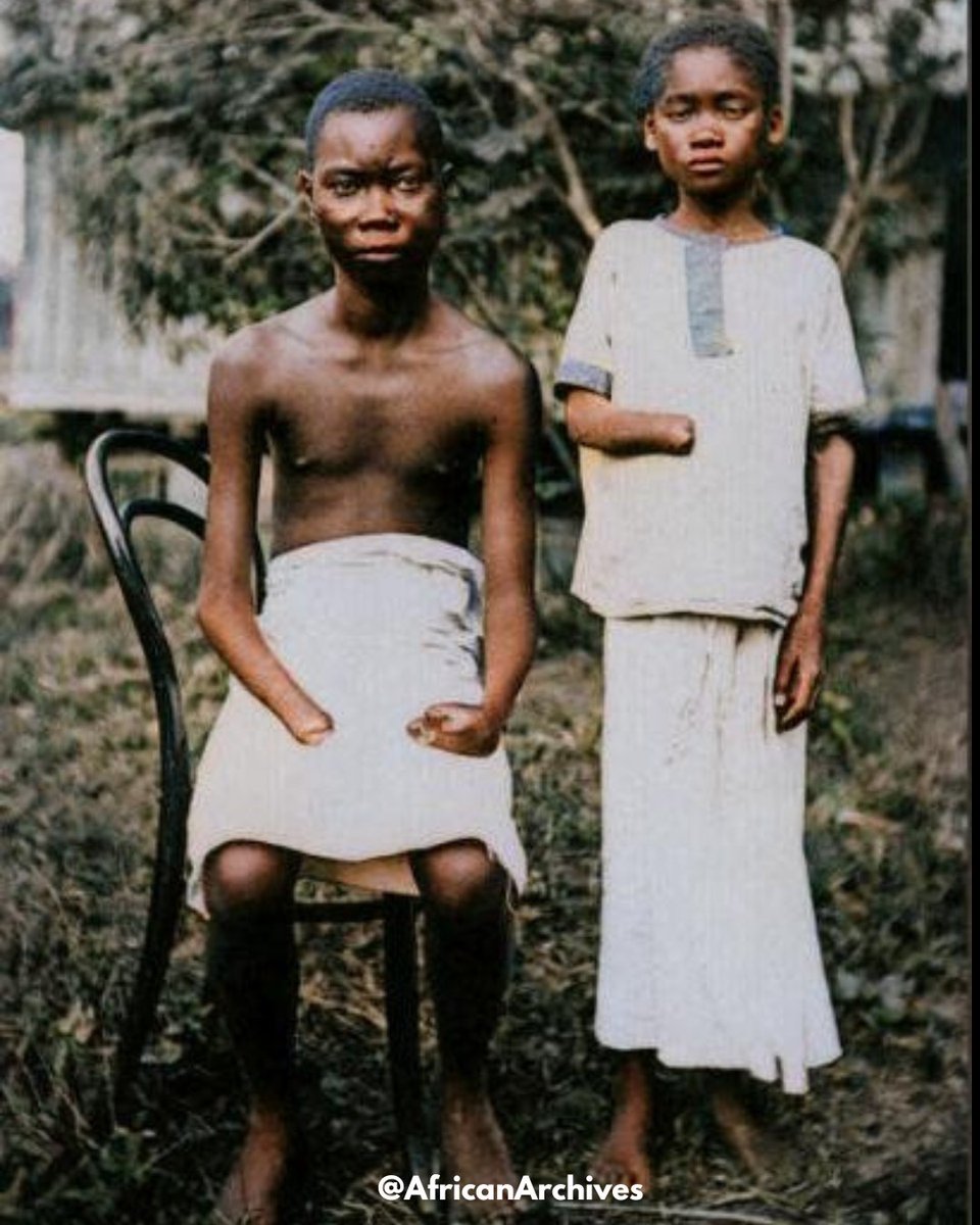 AfricanArchives's tweet image. In King Leopold’s Congo Free state, hands and feet were cut off as punishment for not meeting the daily rubber collection quota, 1904.
