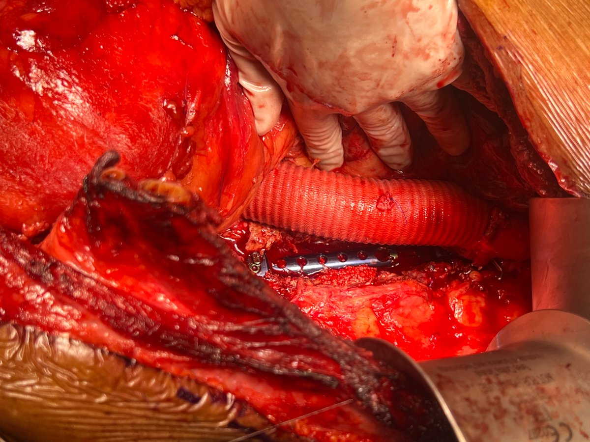 Dr Shivanesan Pitchai tweet media