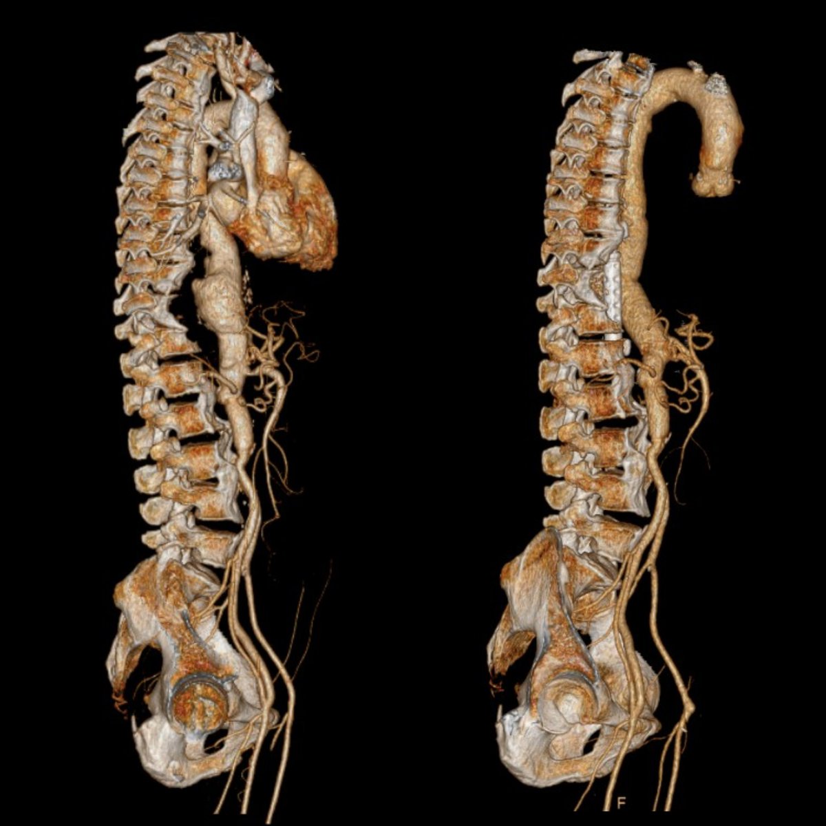 Dr Shivanesan Pitchai tweet media