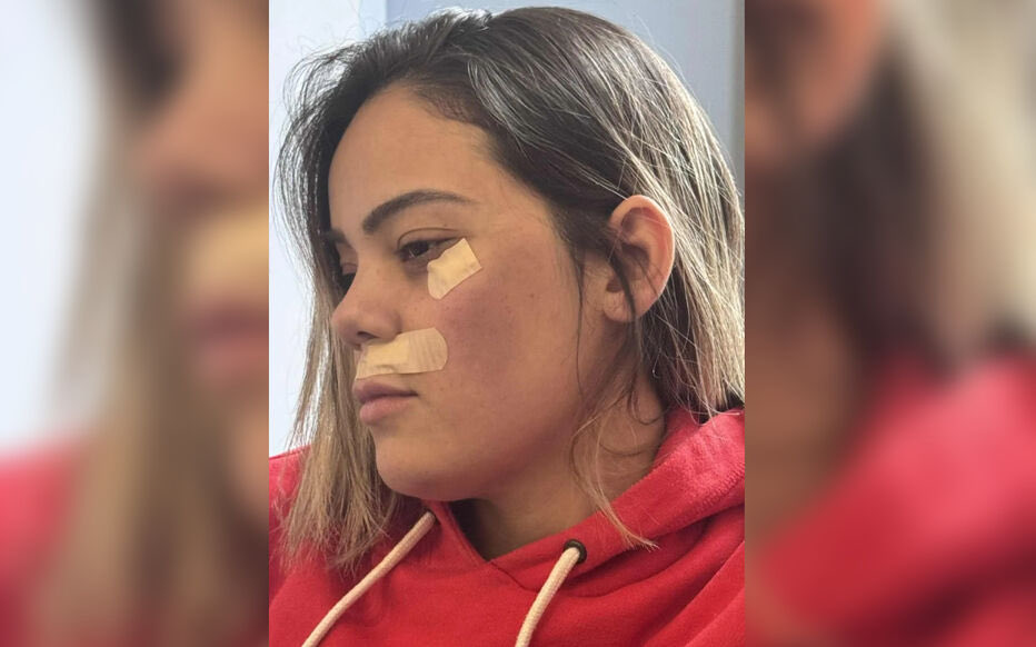 🔴🇫🇷 𝗔𝗟𝗘𝗥𝗧𝗘 𝗜𝗡𝗙𝗢 — Jhordana, une jeune femme de 26 ans, a été MORDUE, GIFLÉE, ÉTRANGLÉE et victime d’une TENTATIVE DE VIOL dans le RER C.

Arrivée récemment du Brésil pour rejoindre son frère à Juvisy-sur-Orge, elle se trouvait SEULE dans la rame au moment des faits.