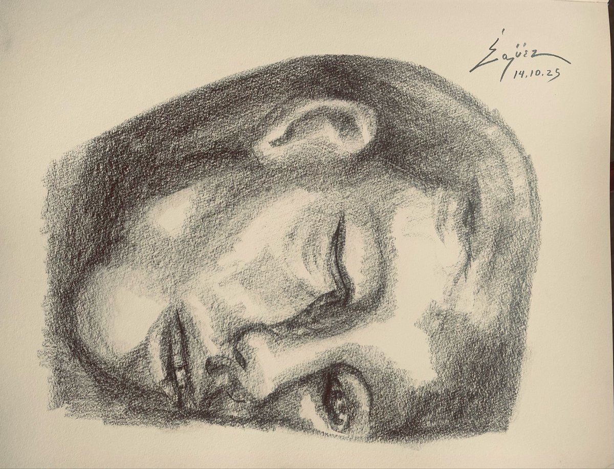 Herido de San Miguel del Común, por el gobierno de la oligarquía bananera. Lápiz sobre papel 2025. 
#TodoNo