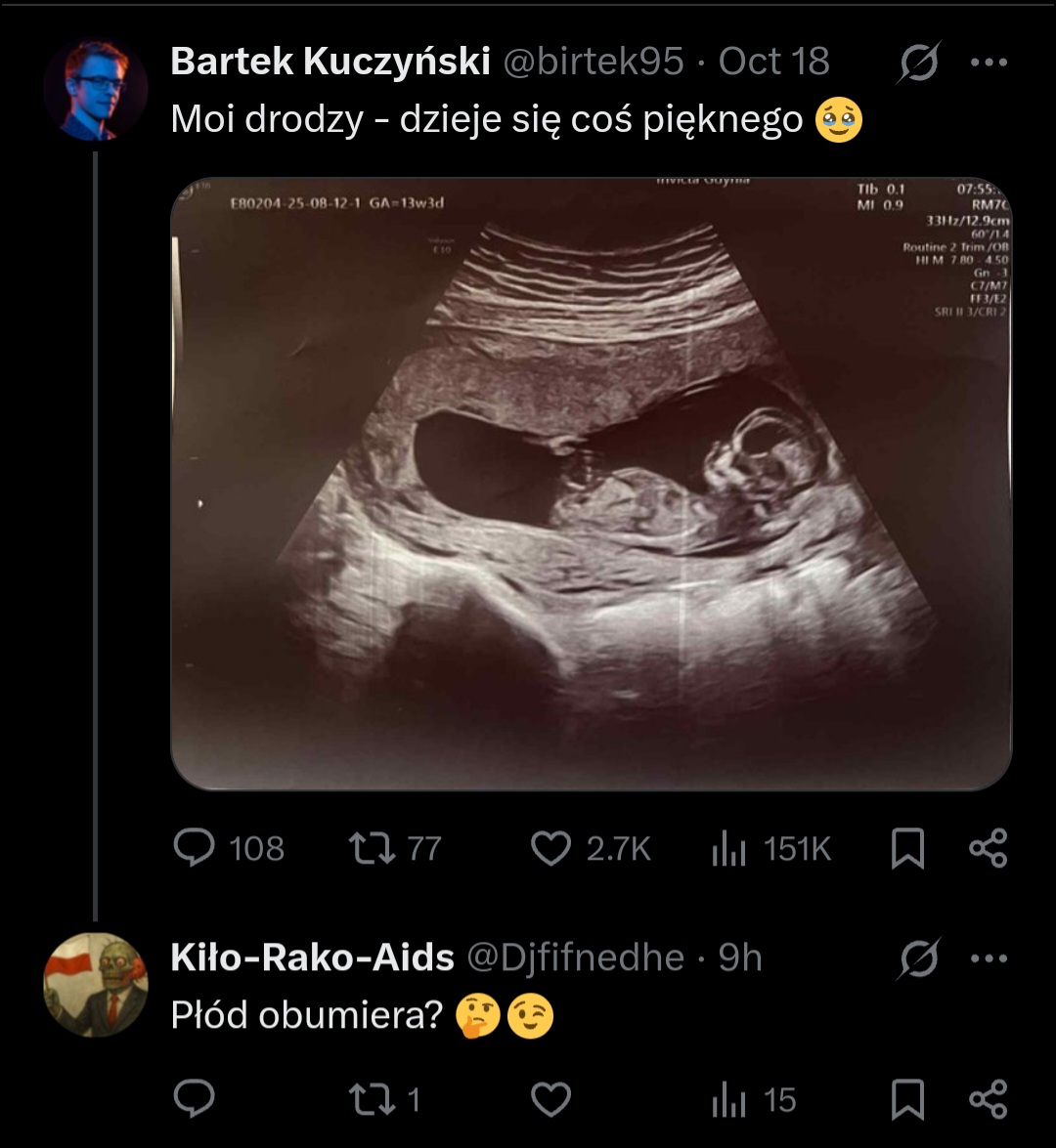 Kiło-Rako-Aids tweet media