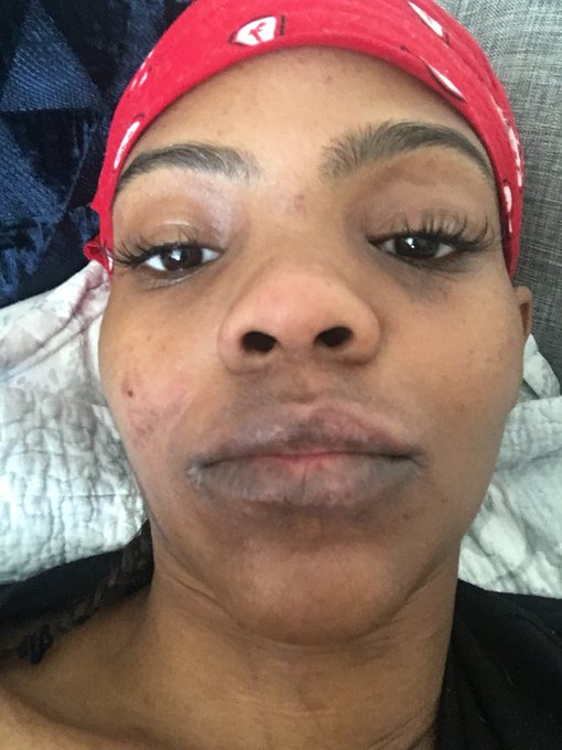 Candace Owens’ loss in the Australian High Court isn’t her first defeat in court: 

Back in 2016, Candace stopped paying rent on her $3,500-a-month luxury apartment in Stamford, Connecticut. She then sued her landlord, claiming she withheld rent because the apartment had black