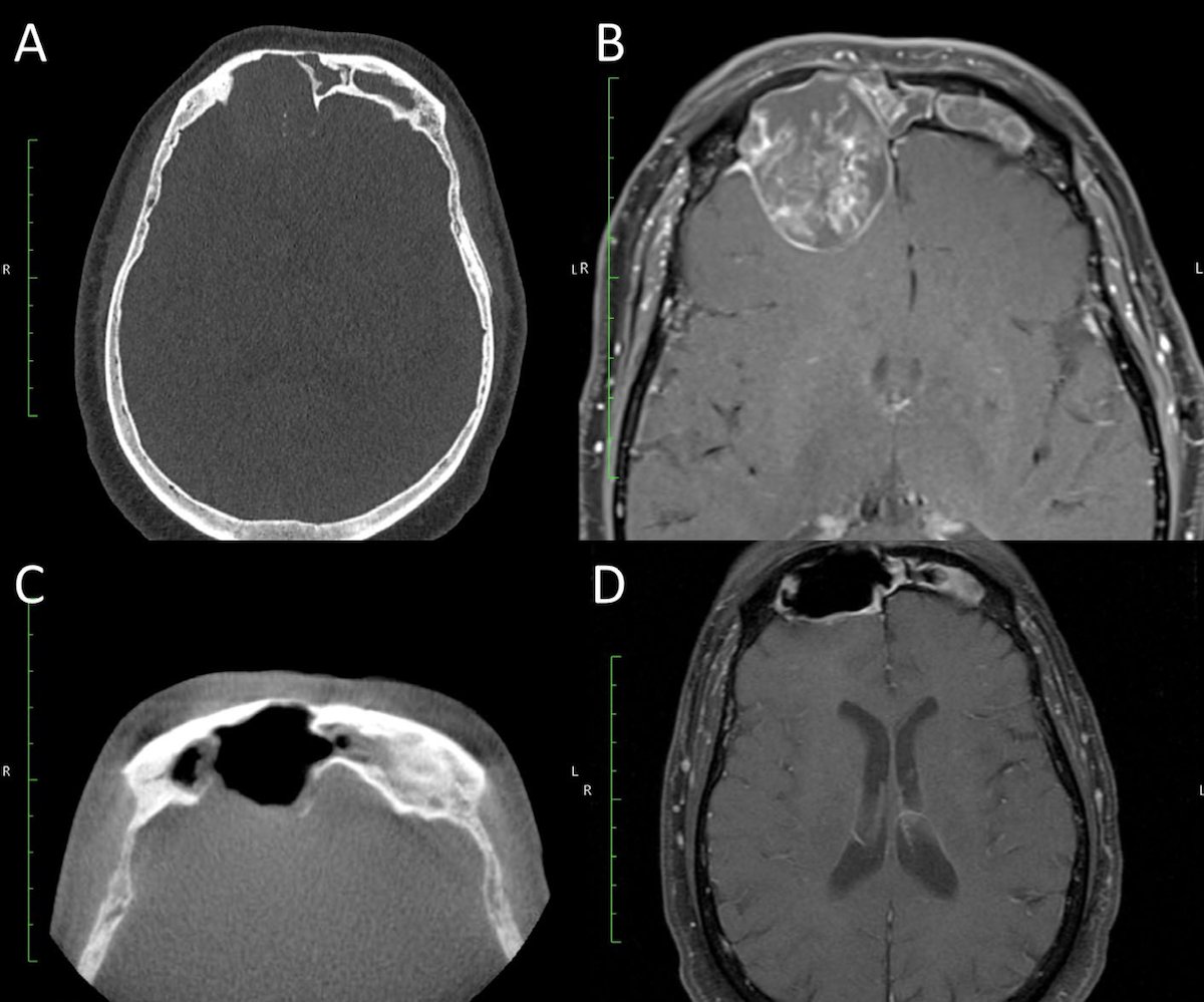 Mayo Clinic ENT tweet media
