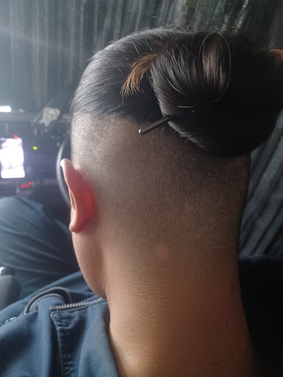 いや、治ったばっかやねん！
と、言っとりますが…
多発性円形脱毛症からはや何年だろうか

やっとできるハゲもここまでちっちゃくなりました😊これが治るのは1年後ですw
そして治ったらまたすぐできるスパイラルw
これが最後にしてくれほんまに(￣▽￣)